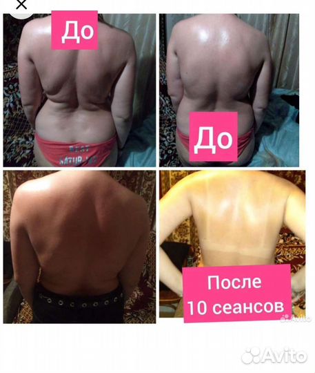 Массаж