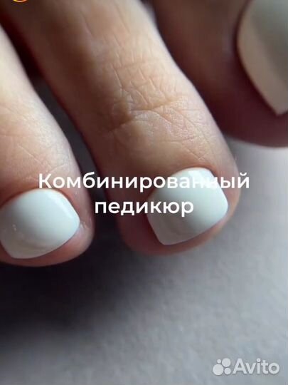 Педикюр аппаратный