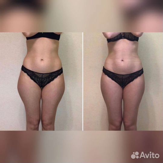 Массаж для женщин