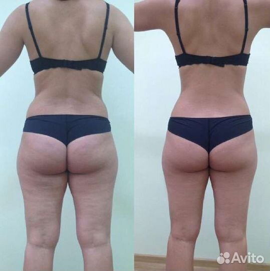 Похудение вместе, Красота и здоровье