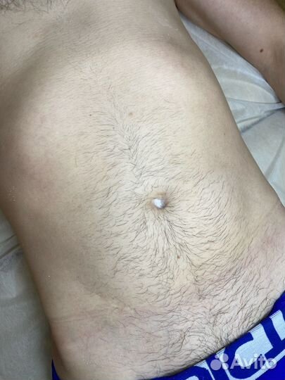 Мужская депиляция, по предоплате