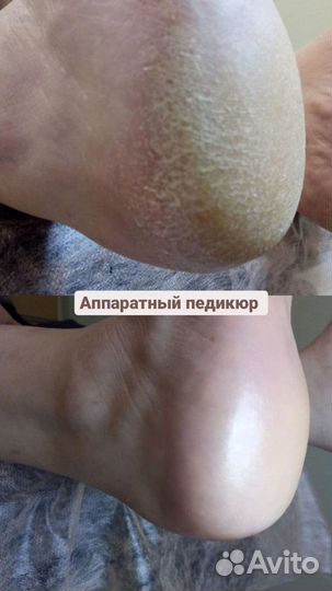 Подолог (педикюр)