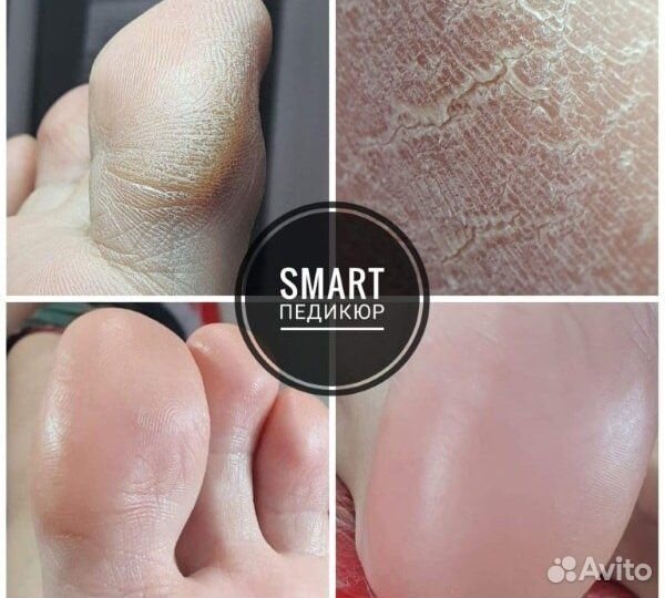 Smart педикюр