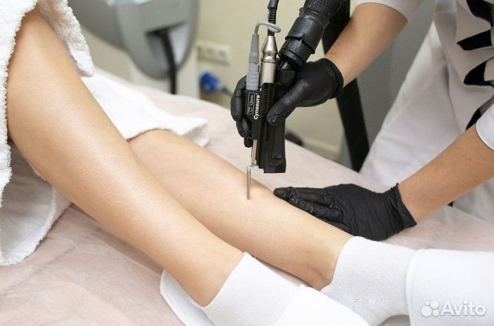 Бизнес лазерной эпиляции под ключ