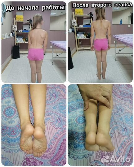 Массажист костоправ