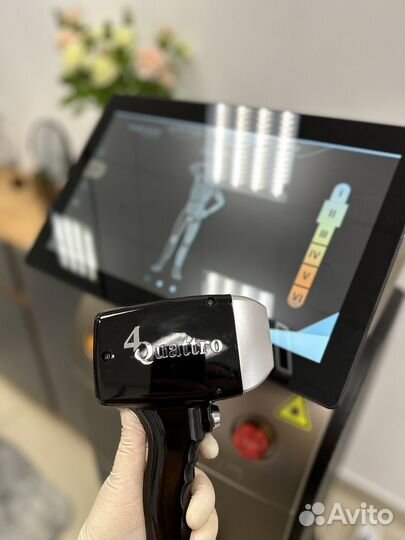 Лазерная эпиляция