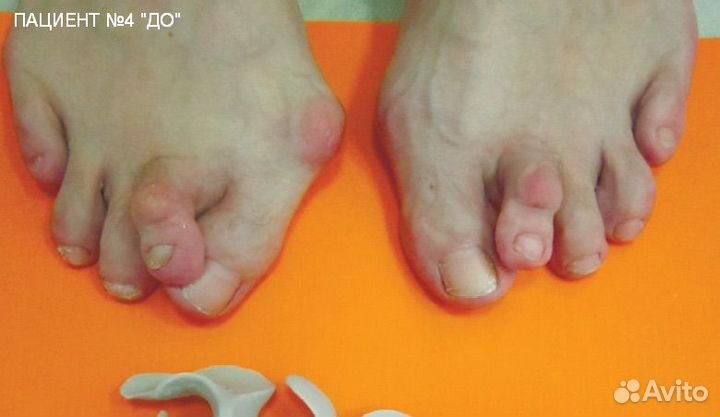 Изготовление индивидуальных отрезов