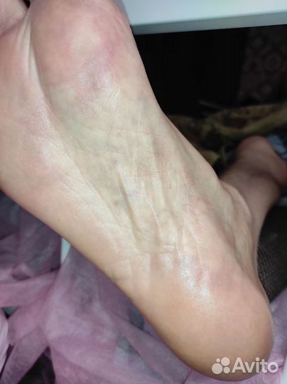 Услуги подолога. Педикюр эстетика