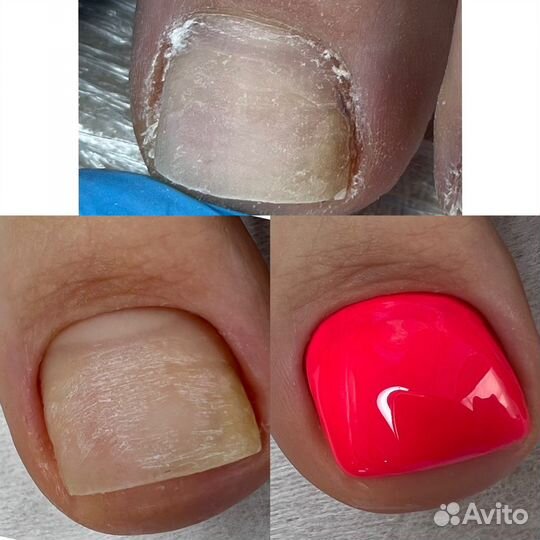 Маникюр, педикюр