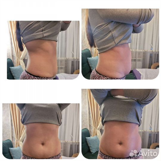 Еmsculpt прокачка мышц, похудение