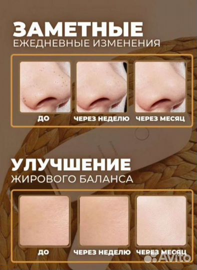 Ультразвуковой аппарат для чистки лица,гель