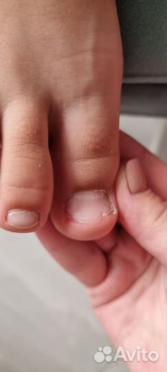 Лечебный педикюр подолог