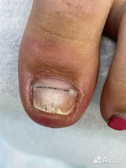 Обучение подологии