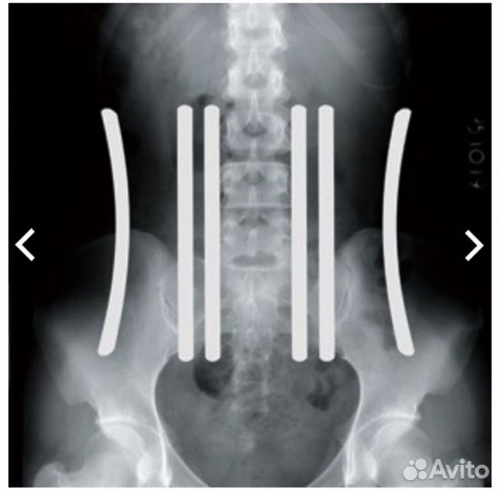 Пояс LP 902 корсет