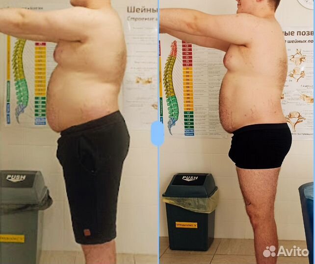 Оздоровительный массаж