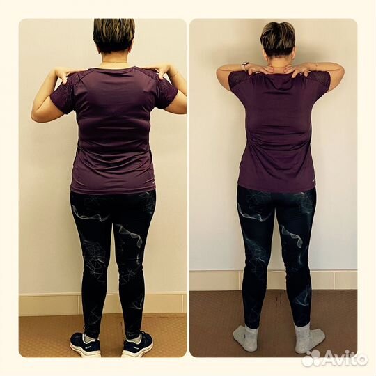 Карамельная липосакция.Аппаратный массаж