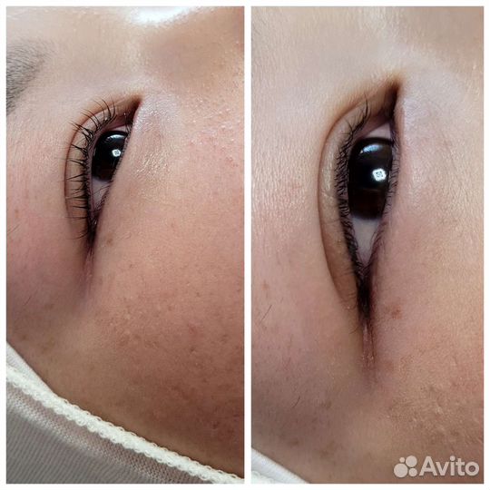 Ламинирование ресниц