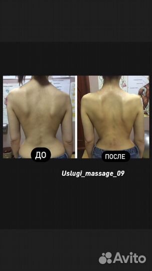 Услуги массажа