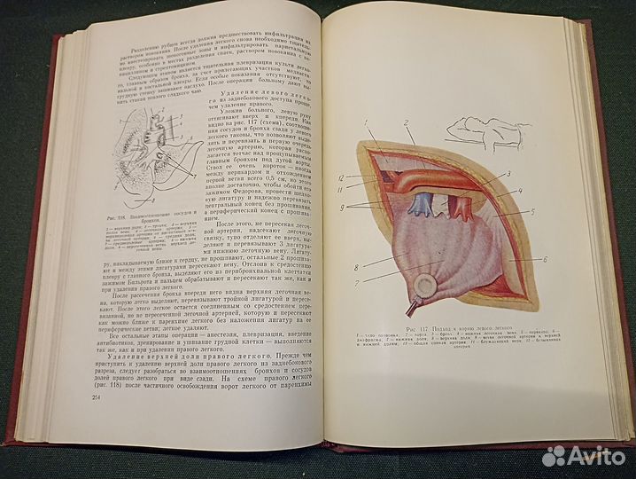 Гнойная хирургия. Стручков. 1962