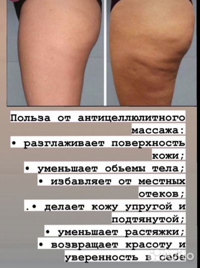 Массаж