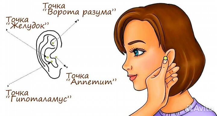 Точка голода (ботулотоксин типа А)