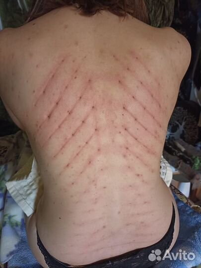 Огненный массаж