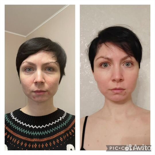 Восстановительный массаж