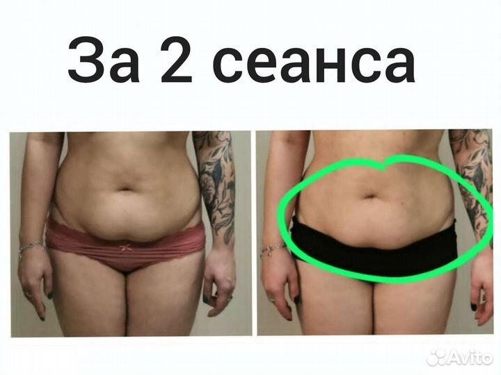 Массаж лечебный релакс