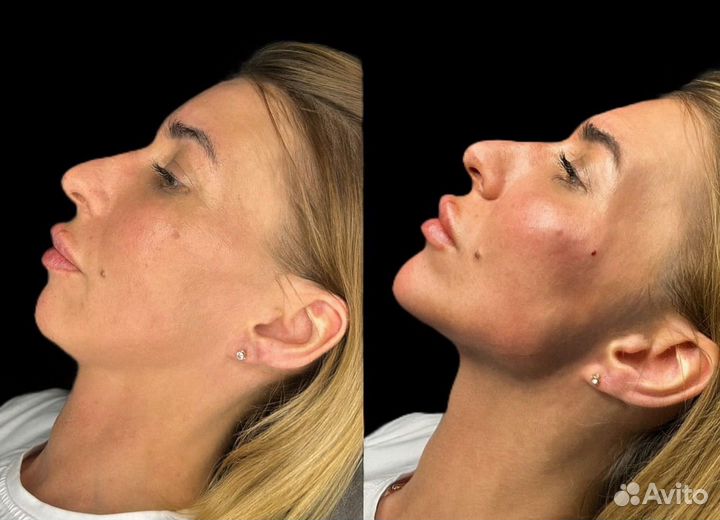 Косметолог лицо под ключ