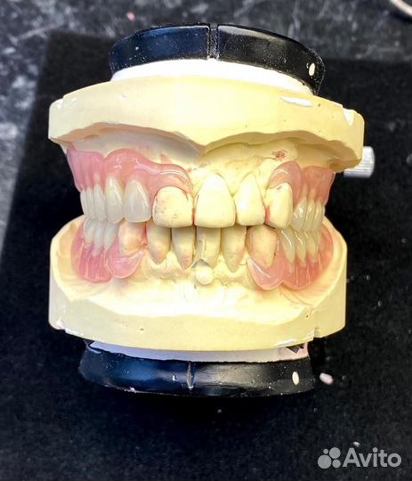 Съемные зубные протезы с выездом на дом,зубы,врач