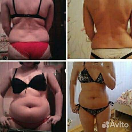 Массаж для похудения