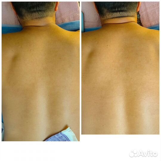 Массаж лечебный. пермь подводников, 94