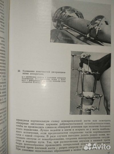 Болезни костей у детей. М.В.Волков.ссср 1974г