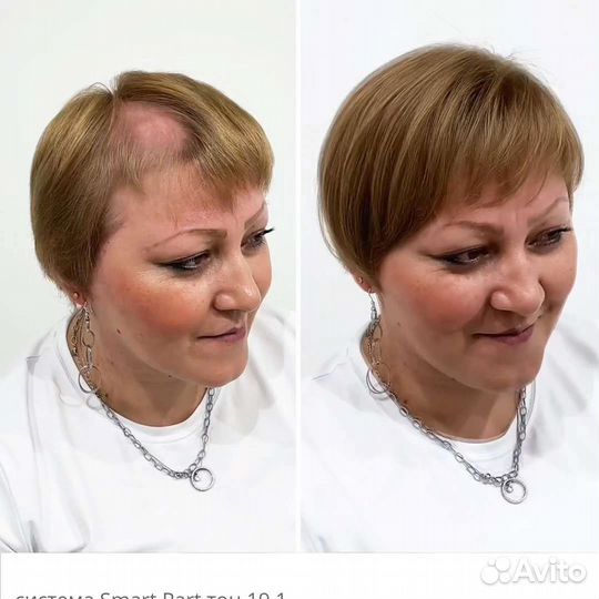 Парикмахерские услуги. Системы замещения волос