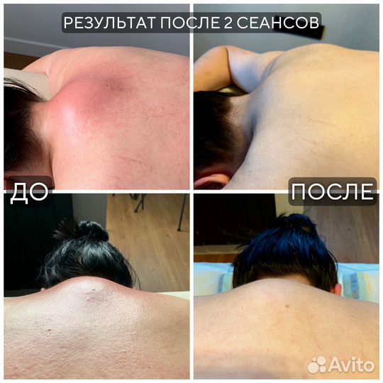 Массаж мануальный,восстанавливающий,Реутов/Новокос