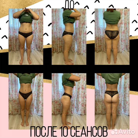 Модели на Антицеллюлитный массаж. Коррекция фигуры