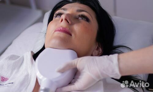 Криолиполиз подбородка