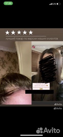 Спрей от выпадения волос