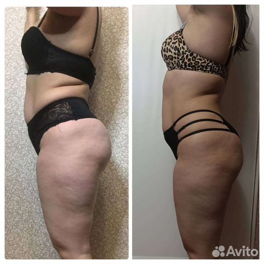 Массаж -эстетическая Коррекция тела и лица