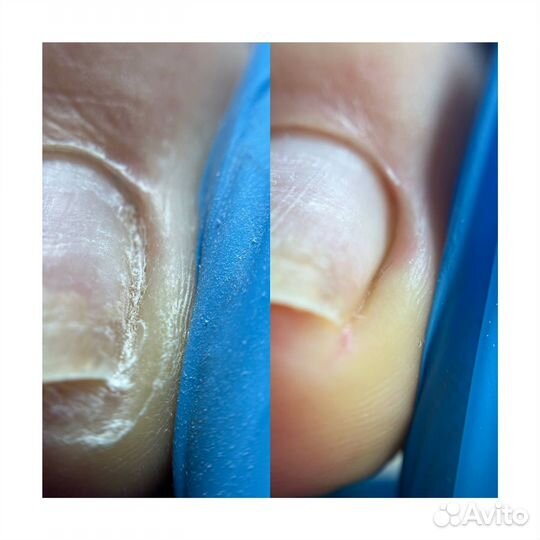 Мастер маникюра и педикюра