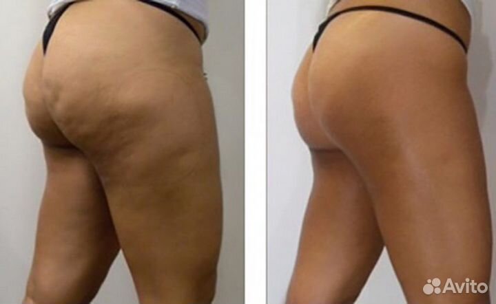 Услуги массажиста