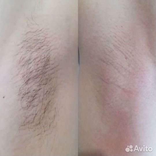 Шугаринг в салоне и с выездом на дом, обучаю тоже