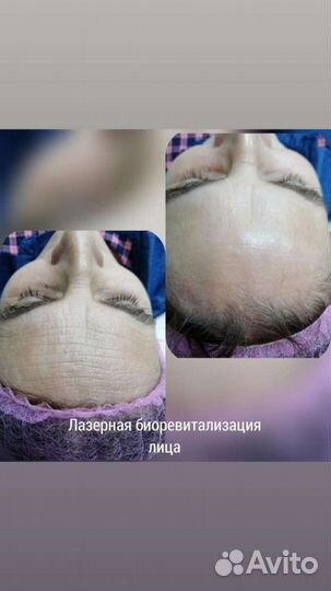 Услуги косметолога