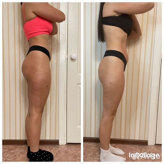 Массаж на дому