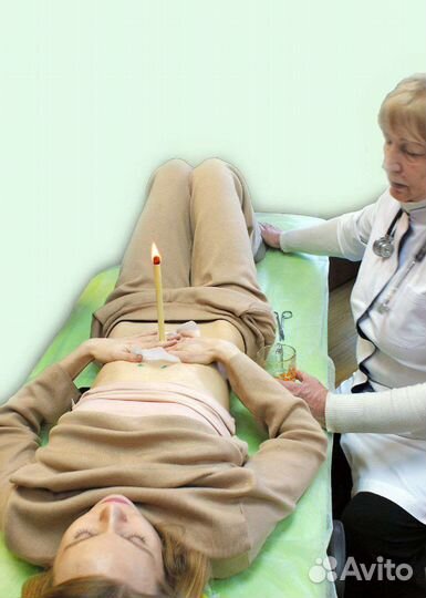 Свечи висцеральные, пупочные