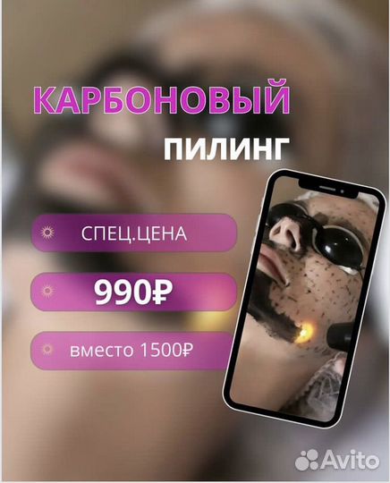 Карбоновый пилинг 990 вместо 1500