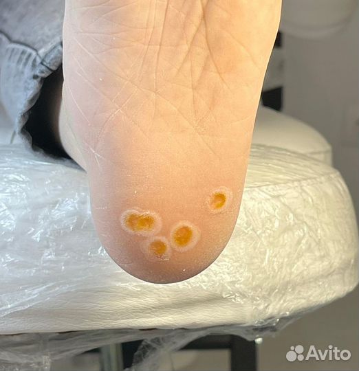 Модели на медицинский педикюр