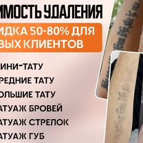 Лазерное удаление татуажа с онлайн записью, Москва