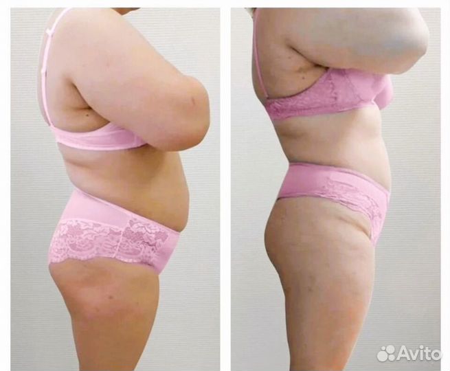 Комплекс для похудения. Прощай живот