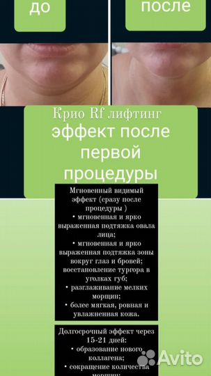 LPG массаж симферополь